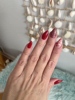 Nails by us - redness. fever and gland pain in severe cases. yellow pus. Chronic paronychia often starts on one nail and spreads to others. The nail folds may have the following symptoms: redness. pain ...